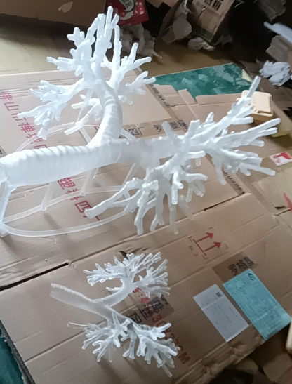 3D打印透明气管支架